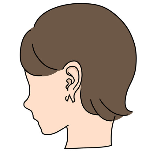耳たぶが割れている・裂けている＝「耳垂裂」といいます