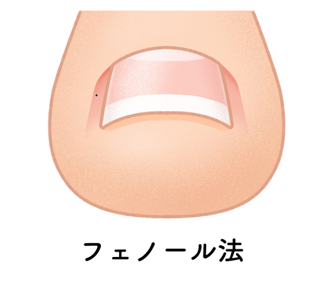 フェノール法